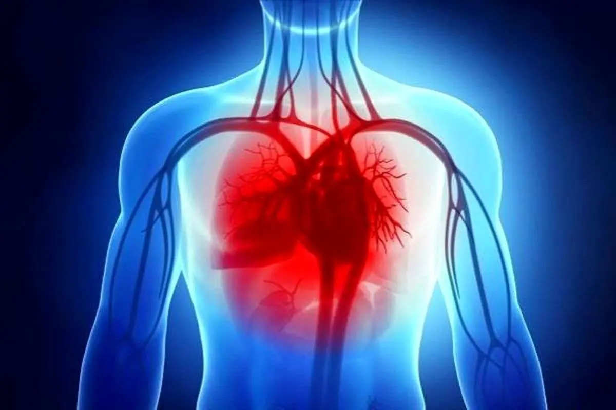 آنچه از سکته قلبی نمیدانید