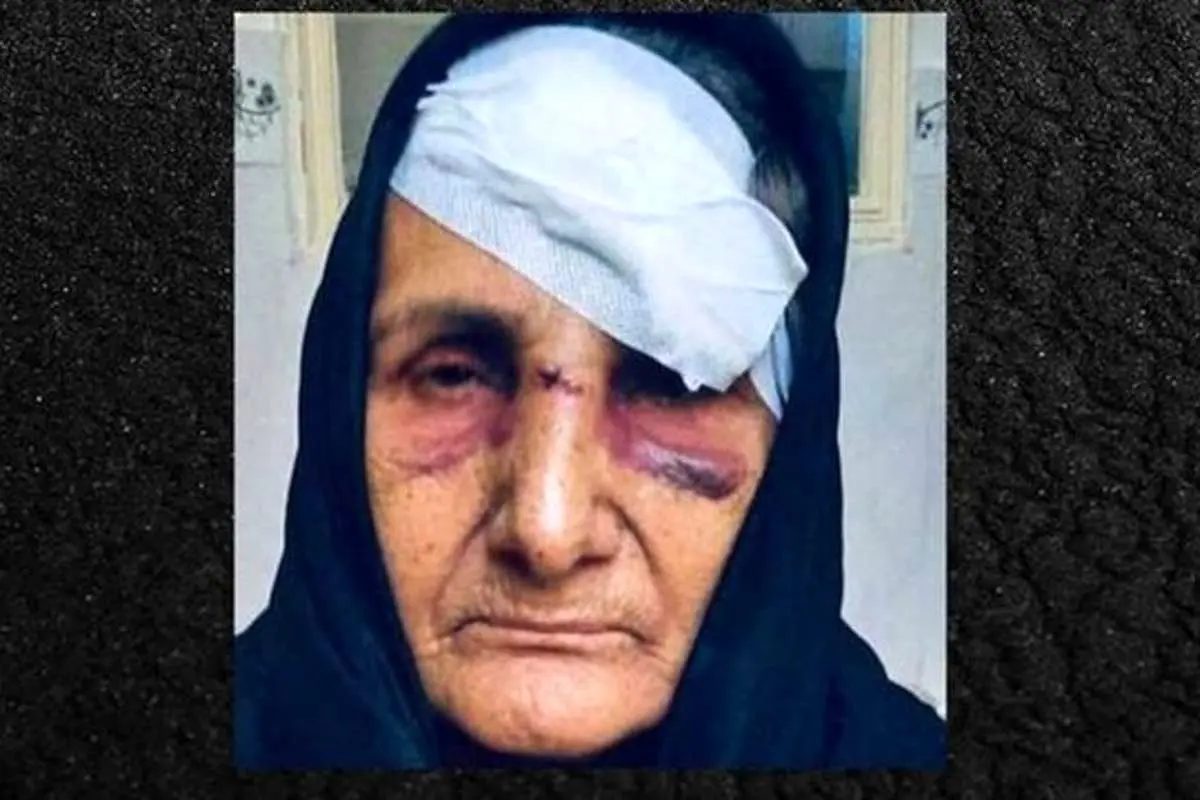 اولین واکنش رسمی به ضرب و شتم گوهر عشقی
