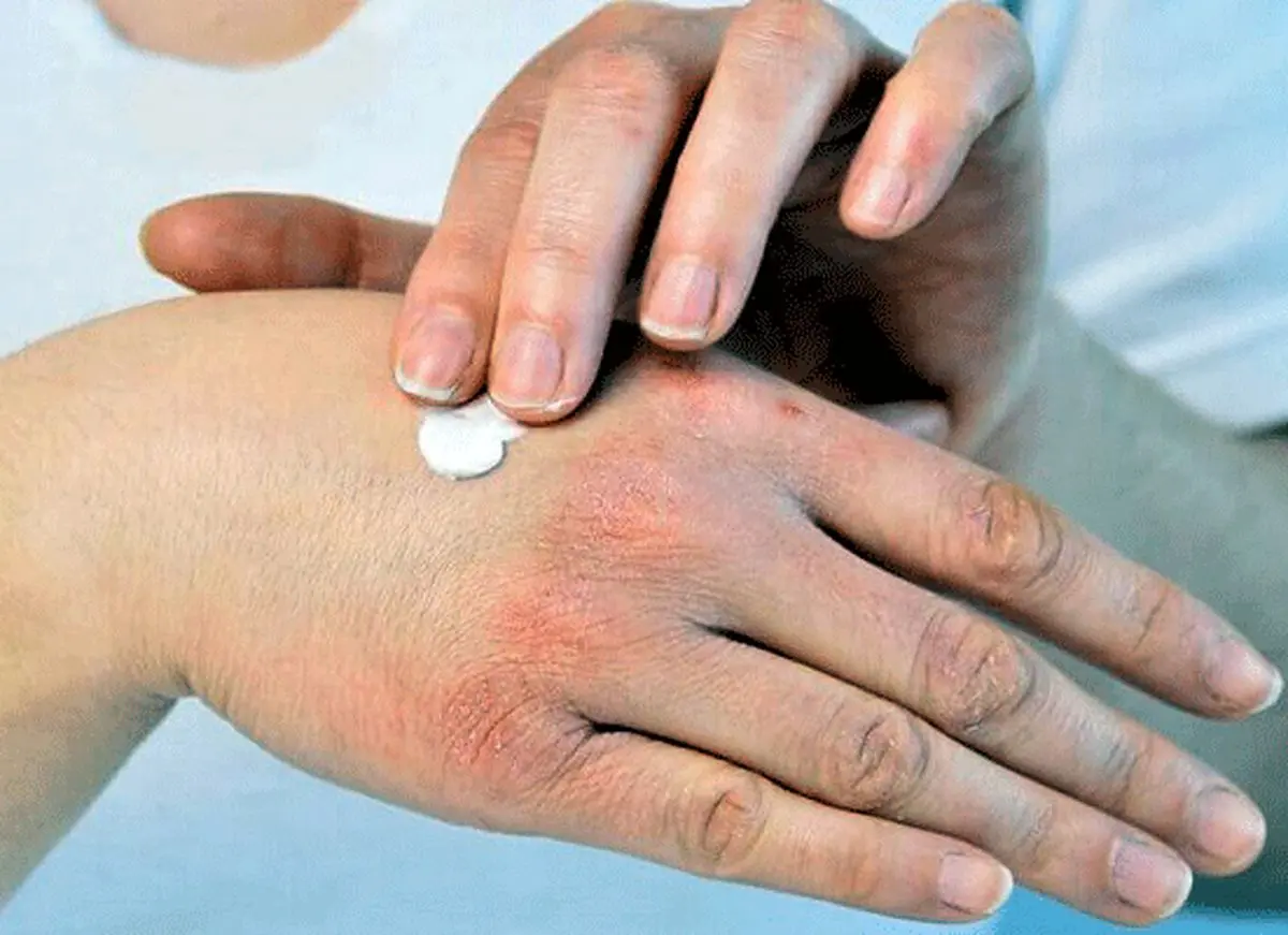 چند راهکار خانگی برای رهایی از خشکی پوست