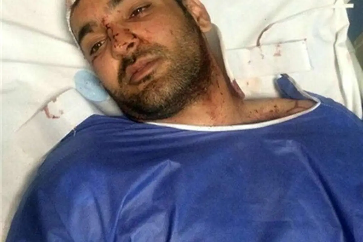 حادثه دلخراش برای ملی پوش دوچرخه سواری ایران در کرمان