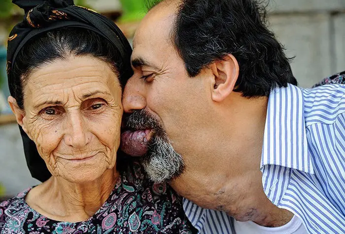 (تصاویر) بیماری دردناک اسماعیل