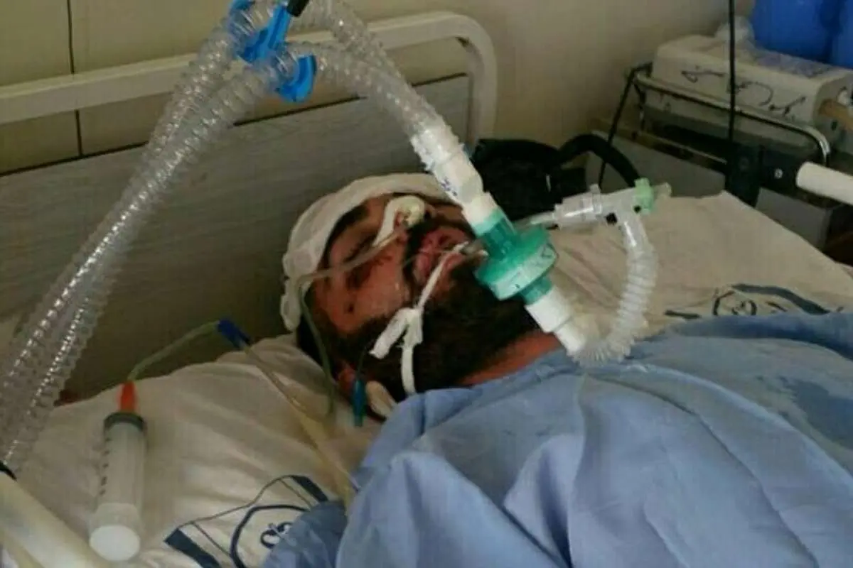 (تصویر) ملی‌پوش سابق و مربی دوچرخه‌سواری به کما رفت