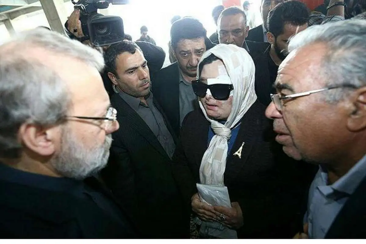 (تصویر) گفتگوی یک قربانی اسیدپاشی با لاریجانی