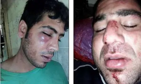 (عکس) ضرب وشتم دو پناهجوی ایرانی در مانوس