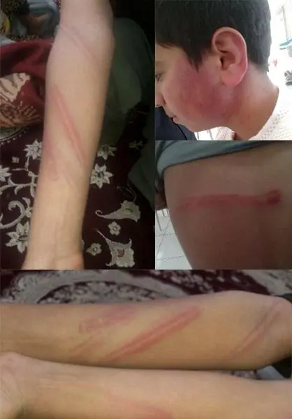 (عکس) کتک خوردن بی رحمانه دانش آموز در قائن