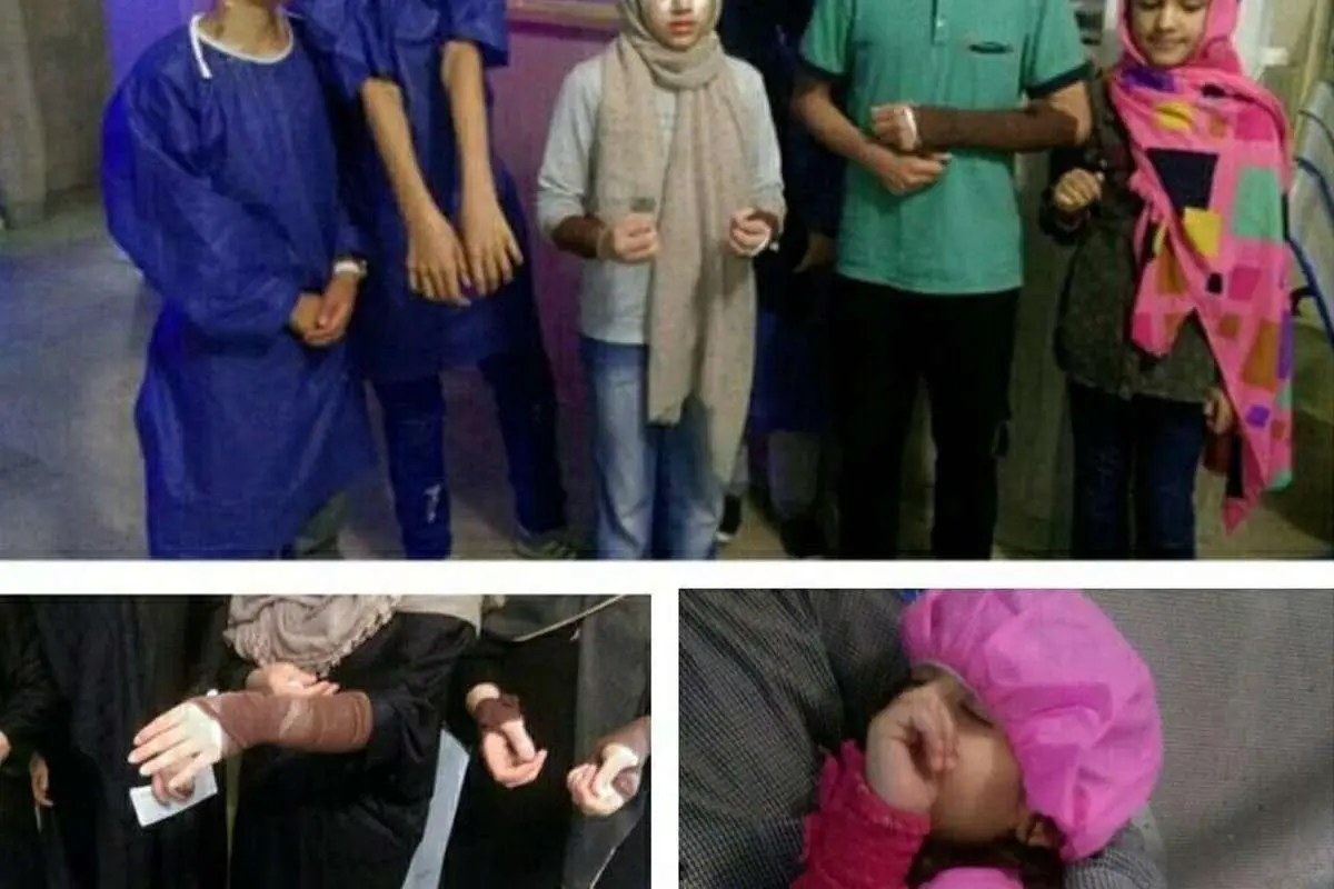 اسیدپاشی به 16 نفر در بلوار فدائیان اسلام