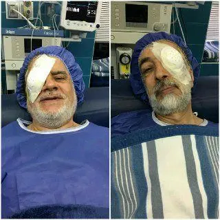 چشم چپ حدادعادل و چشم راست عارف!