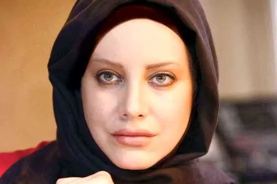 بازیگر زن: قرار بود بروم مسکو پزشک شوم