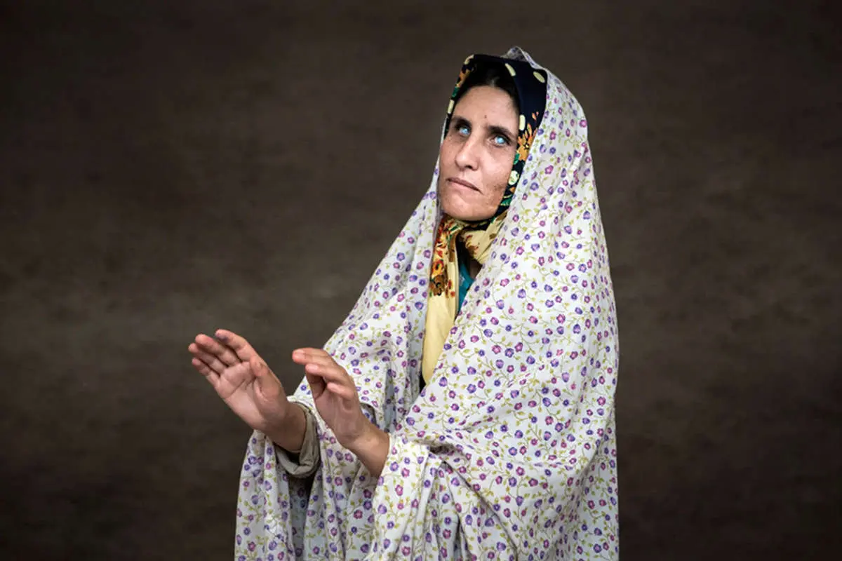 (تصاویر) معضل ژنتیکی عجیب در خراسان شمالی