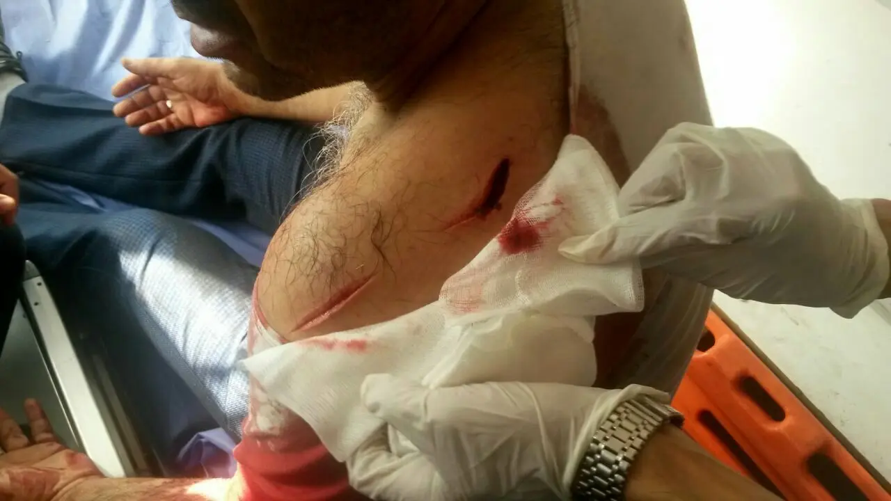 حمله با چاقو به مسافران در ترمینال جنوب