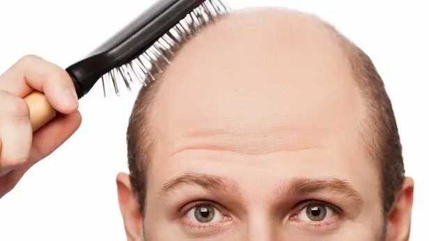 سفیدی و ریزش مو با بیماری قلبی ارتباط دارد