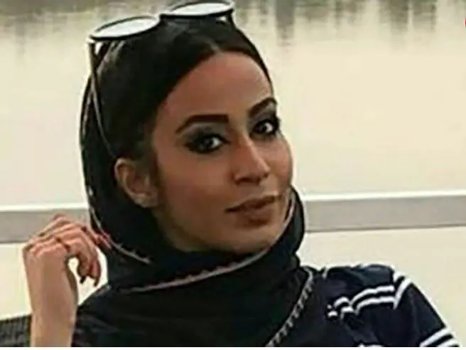 مرگ قهرمان زن ژیمناستیک با عمل زیبایی
