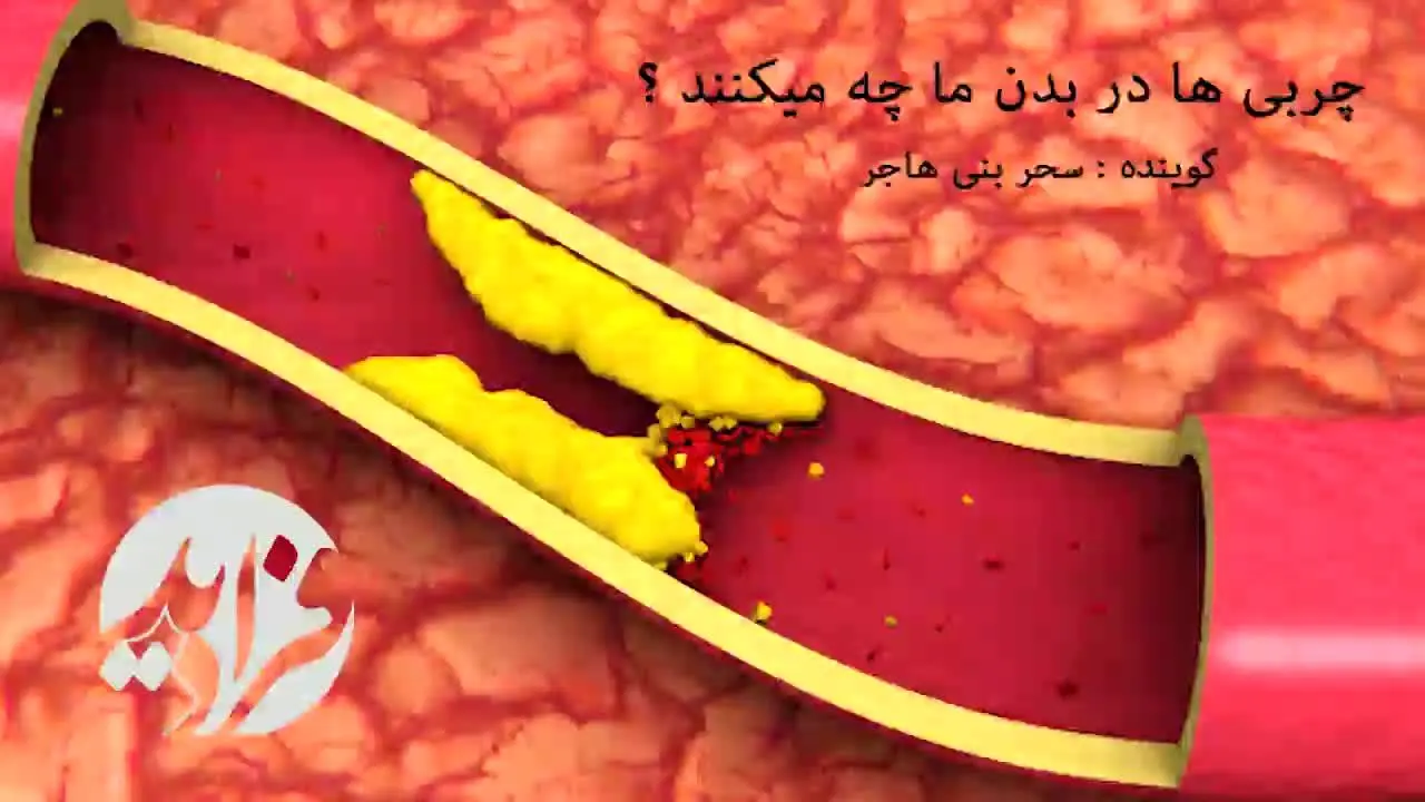 (بشنوید) چربی‌ها با بدن ما چه می‌کنند؟