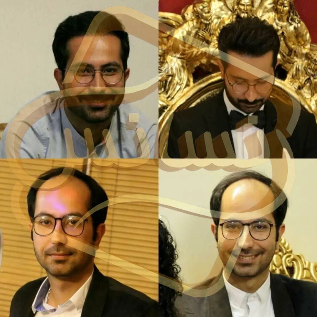 از سیر تا پیاز کاشت مو و کاشت ریش