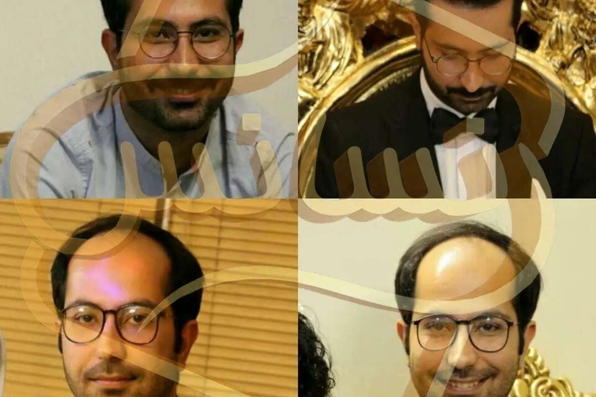 از سیر تا پیاز کاشت مو و کاشت ریش