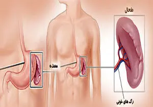 طحال چیست،کجاست و چه می کند؟
