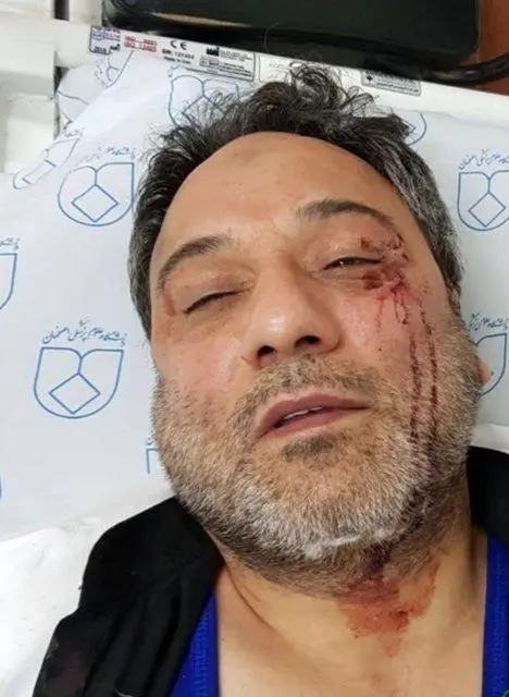 ضرب و شتم پزشک اصفهانی توسط همراهان بیمار