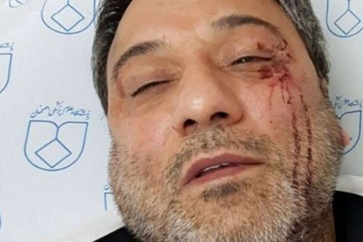 ضرب و شتم پزشک اصفهانی توسط همراهان بیمار
