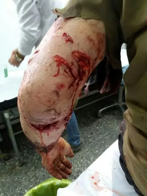(عکس) حمله خونین پلنگ به مرد زنجانی