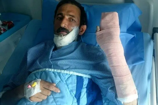 (عکس) فک، زبان و دست قطع شده مصدوم ۳۹ ساله پیوند خورد!