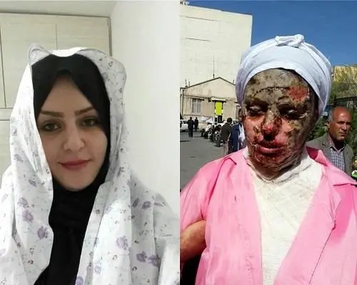 «معصومه» در تهران درمان می‌شود
