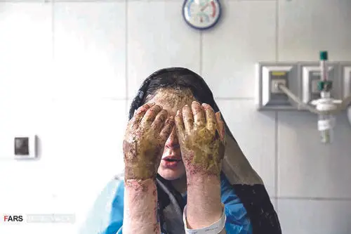 گسترش حملات اسیدی در شمال غرب