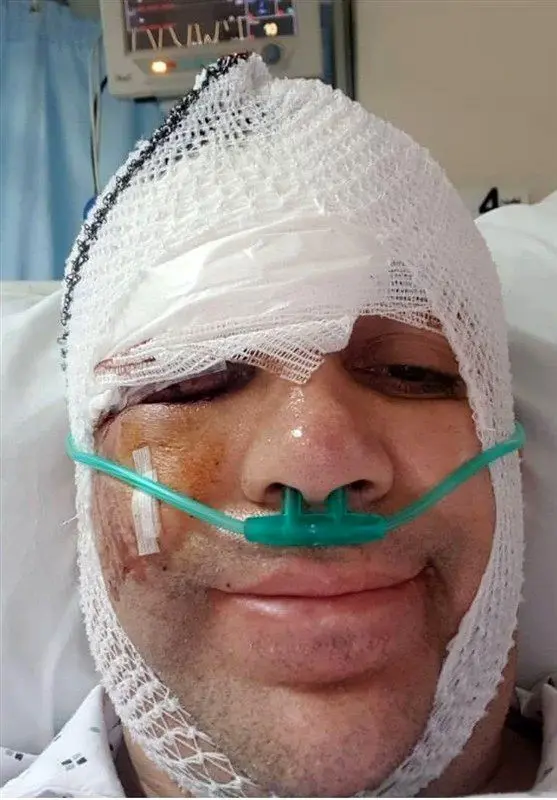 مصدومیت شدید امیر کربلایی‌زاده در تصادف با اتوبوس