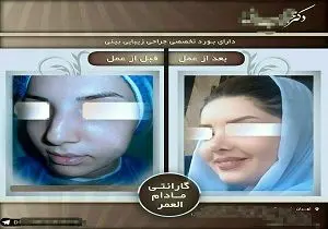 دماغ عروسکی با گارانتی مادام العمر