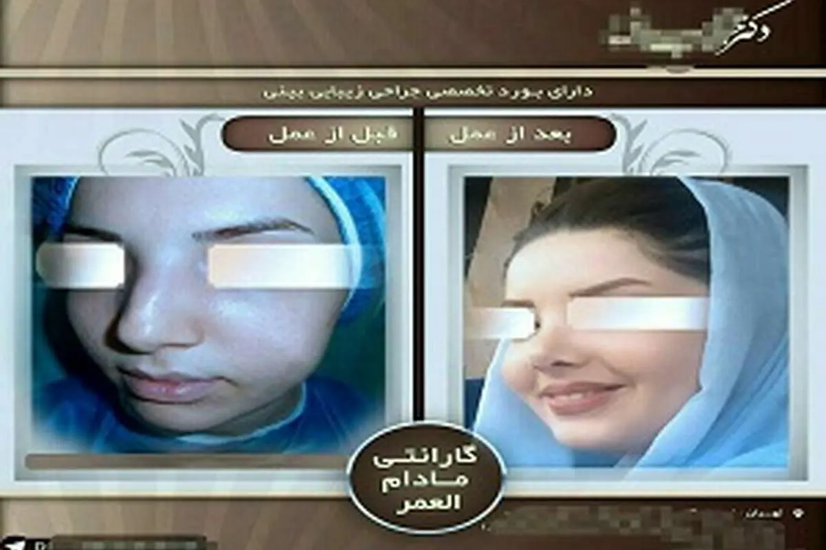 دماغ عروسکی با گارانتی مادام العمر