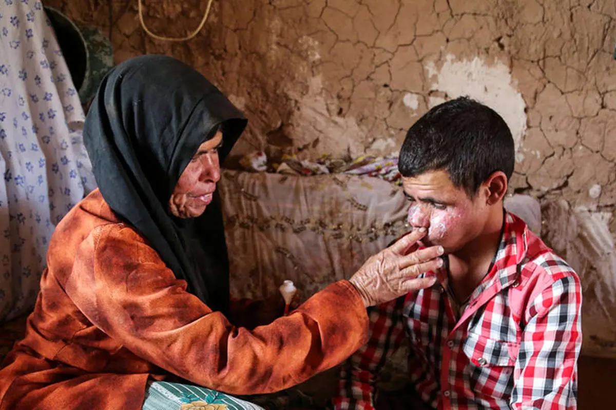 (تصاویر) سیلی خشکسالی بر صورت کودکان «درمیان»