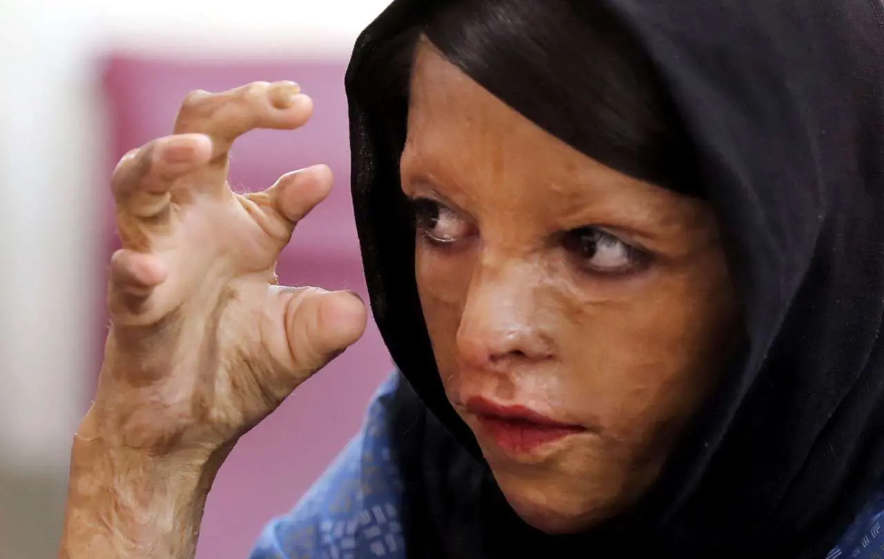 (تصاویر) دیدار دختران «شین‌آبادی» با معصومه ابتکار