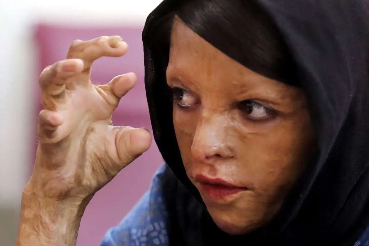 (تصاویر) دیدار دختران «شینآبادی» با معصومه ابتکار