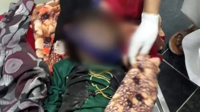 دختر هفت ساله افغان توسط شوهرش کشته شد