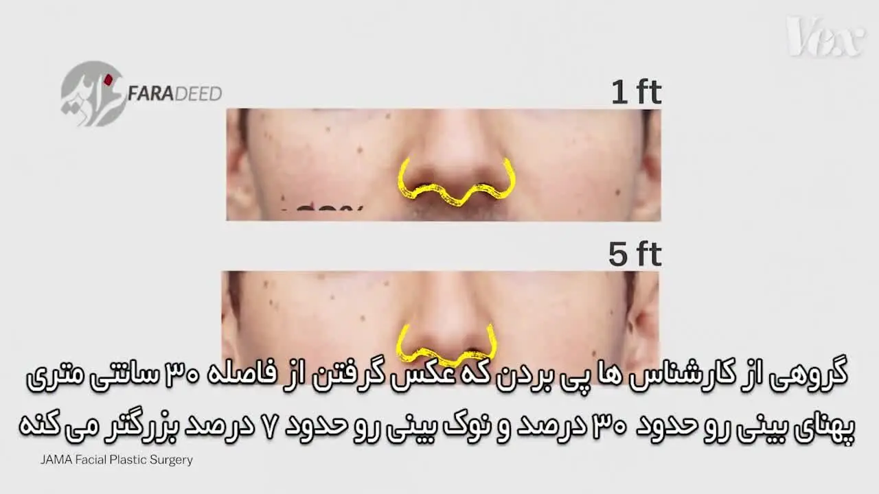 (ویدیو) چطور سلفی باعث می‌شود جراحی زیبایی کنید؟!