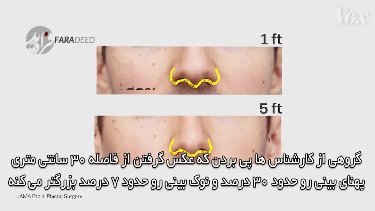 (ویدیو) چطور سلفی باعث می‌شود جراحی زیبایی کنید؟!