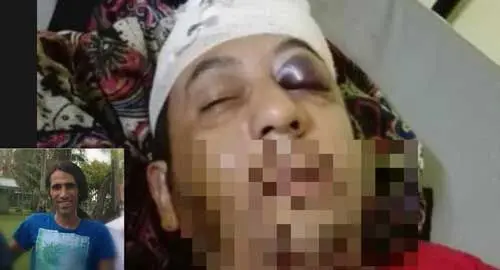 (تصویر) حمله به پناهجوی ایرانی در استرالیا