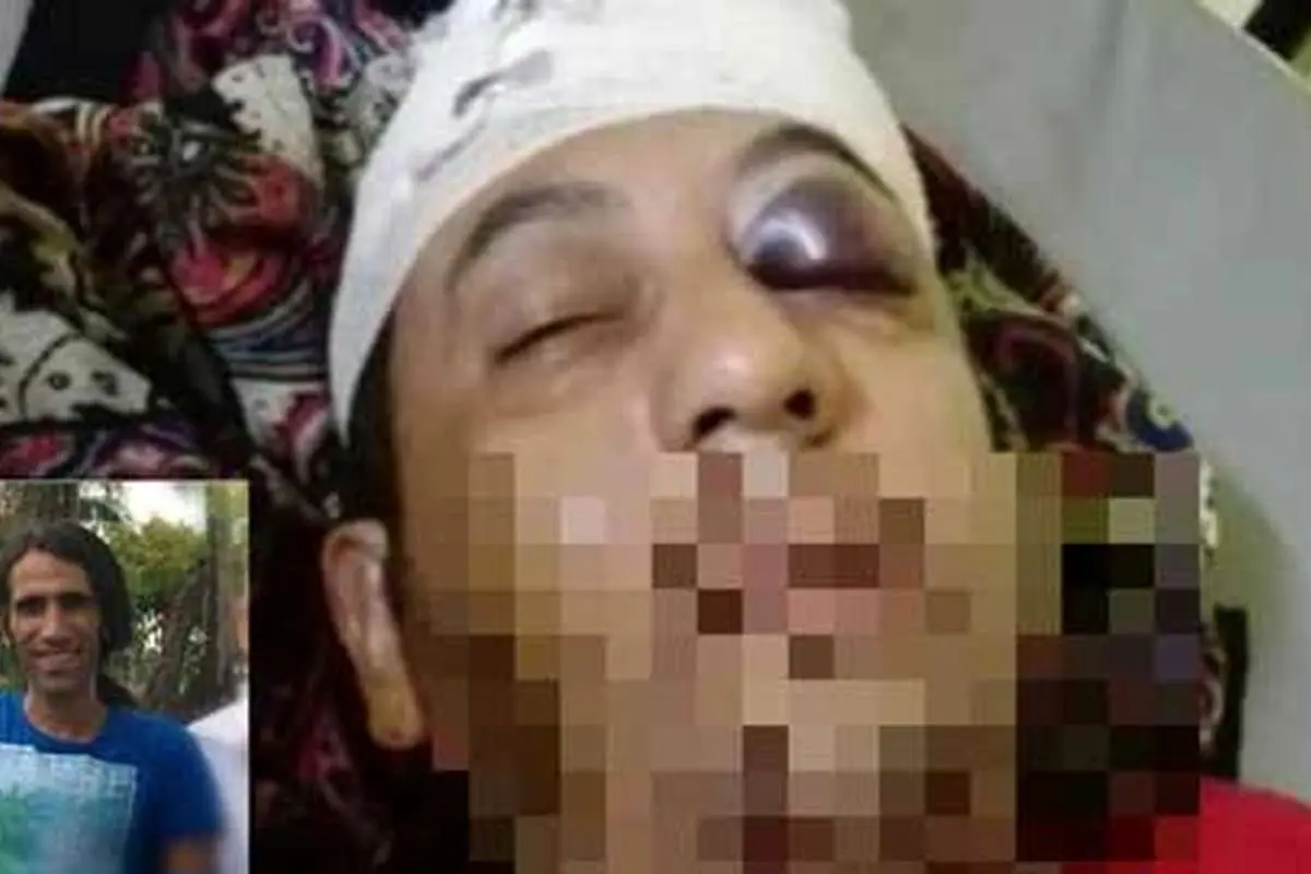 (تصویر) حمله به پناهجوی ایرانی در استرالیا