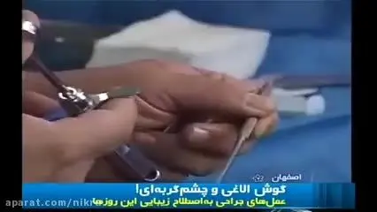 جراحی‌های گوش الاغی و چشم‌گربه‌ای قابل تعقیب کیفری است