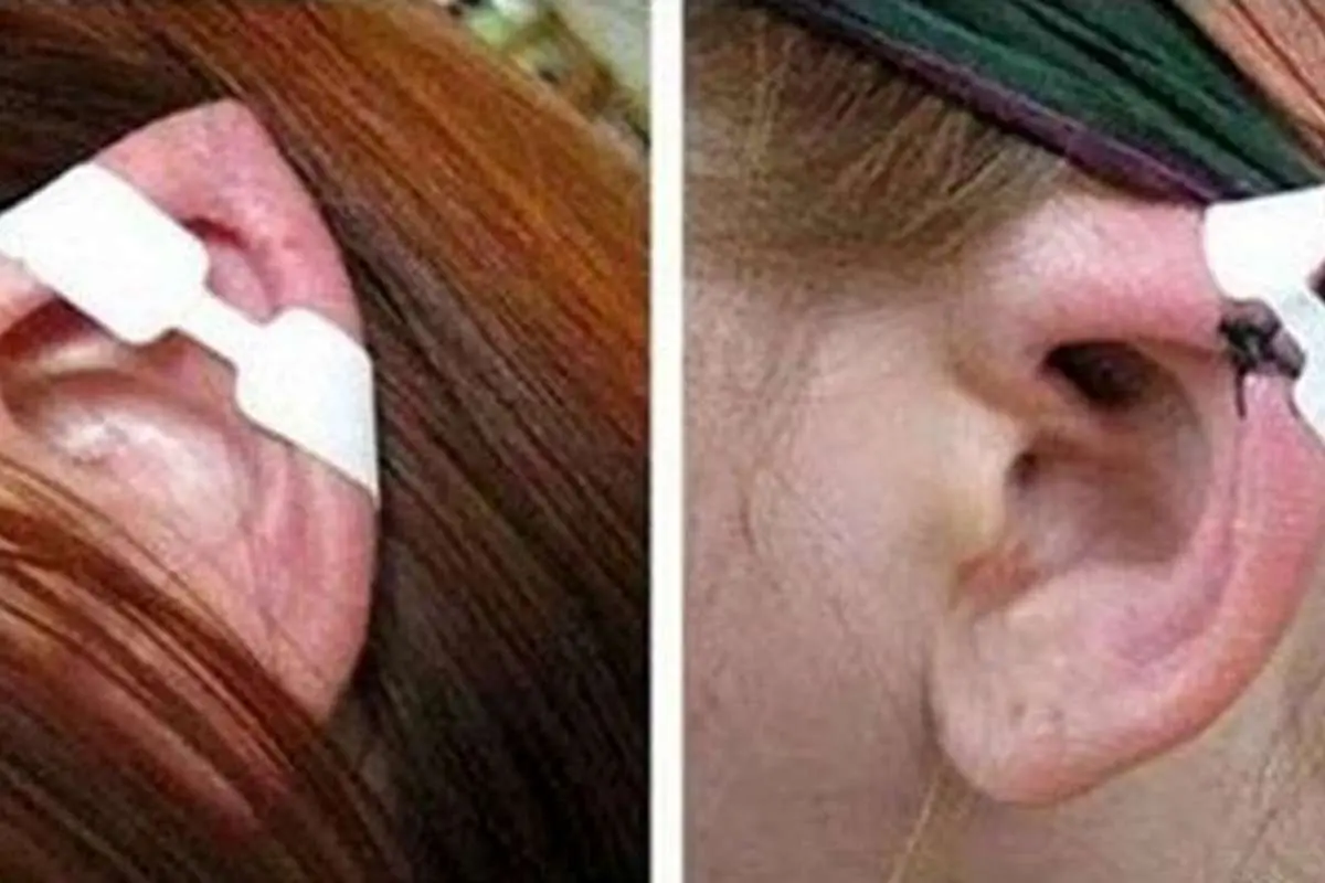 گوش الاغی، چشم گربهای، لب شتری و دماغ خوکی!