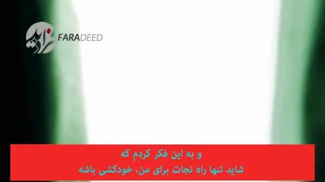 (ویدیو) جزییات جدیدی از رسوایی جنسی بیل کلینتون