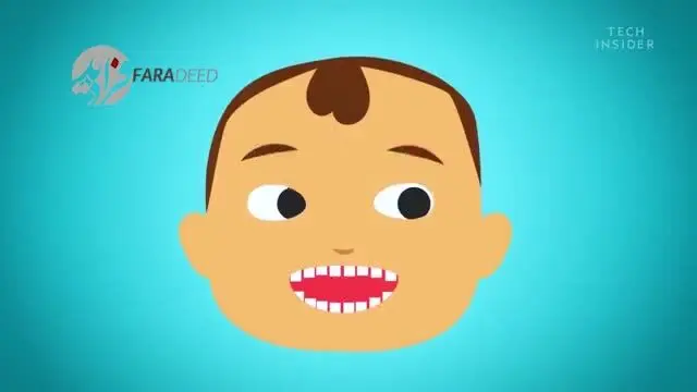(ویدیو) دندان عقل چیست و چرا باید آن را کشید؟