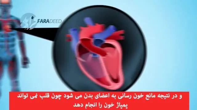 (ویدئو) با ایست قلبی چه اتفاقی رخ می‌دهد؟