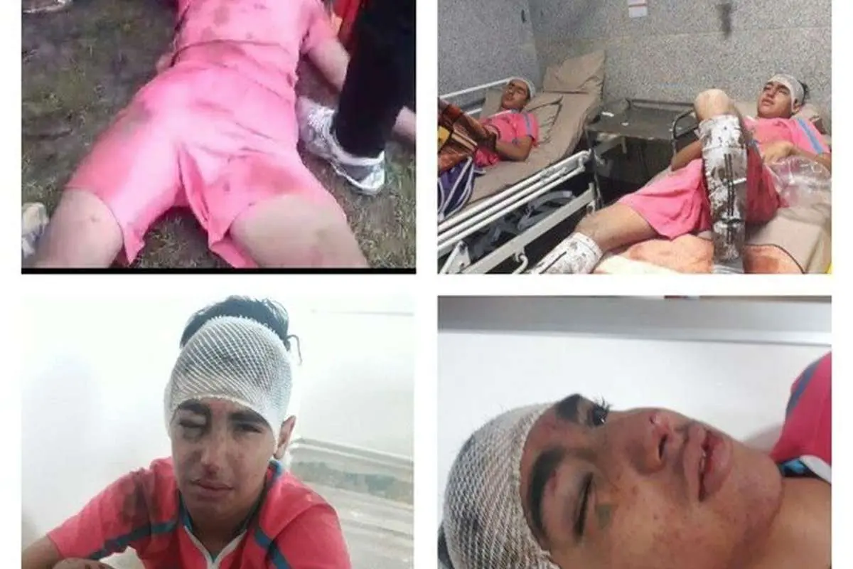 (تصویر) جنجال در لیگ برتر فوتبال نوجوانان
