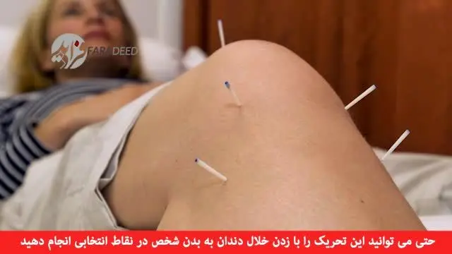 (ویدیو) آیا طب سوزنی واقعا شفابخش است؟