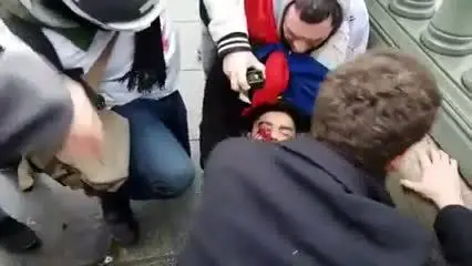 (ویدیو) پلیس فرانسه معترض جلیقه‌زرد را نابینا کرد