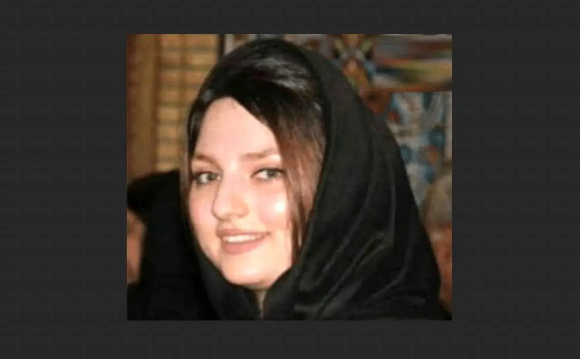 مرگ تلخ «سوزان» زیر تیغ جراحی زیبایی