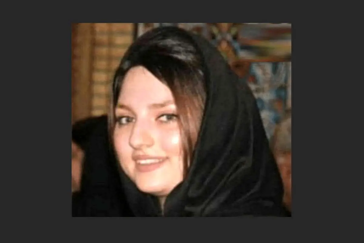 مرگ تلخ «سوزان» زیر تیغ جراحی زیبایی