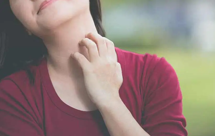 اگزما پوستی چیست؛ چه علائمی دارد و برای درمان اگزما چه باید کرد؟