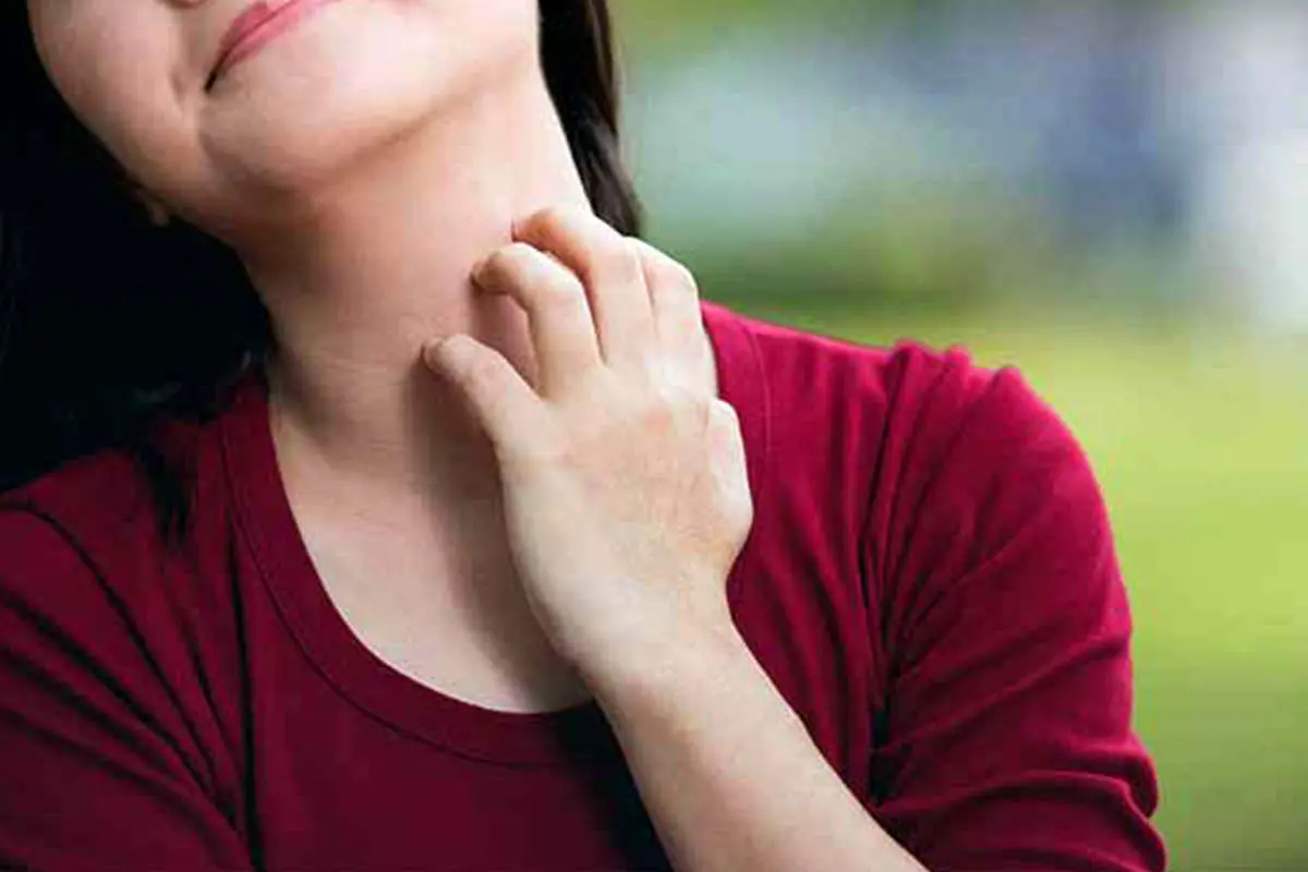 اگزما پوستی چیست؛ چه علائمی دارد و برای درمان اگزما چه باید کرد؟