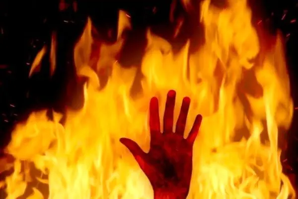 مرد جوان پس از شنیدن جواب منفی از همسر صیغه‌ای خودش را آتش زد!